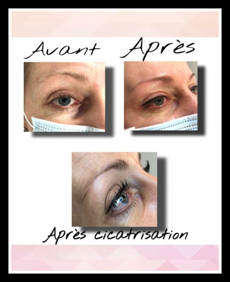 maquillage permanent eye liner sarrebourg