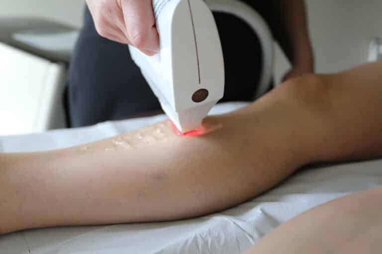 Épilation à la lumière pulsée chez Bianca Beauté à Phalsbourg